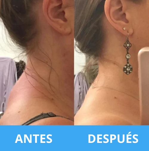 Vibroslim Body Massager™ - Dispositivo para el alivio del dolor crónico