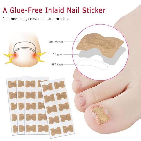 Parche para uñas de los pies sin pegamento (50 uds.)