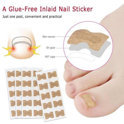 Parche para uñas de los pies sin pegamento (50 uds.)