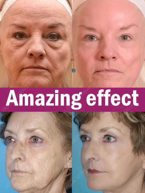 CONTORNO DE OJOS ANTIRARRUGAS"®️ ⭐⭐⭐⭐⭐ ORIGINAL