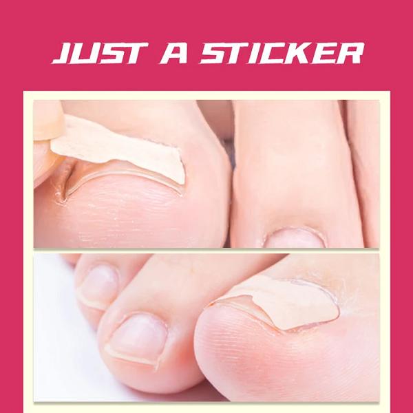 Parche para uñas de los pies sin pegamento (50 uds.)