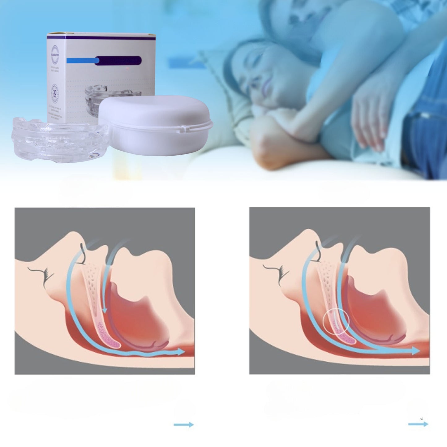 TENDENCIA! PROSLEEP: LA SOLUCIÓN CONTRA LOS RONQUIDOS! 💤🚀  ®️ ⭐⭐⭐⭐⭐ ORIGINAL